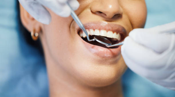 Best Emergency Tooth Extraction in Oakland, OK