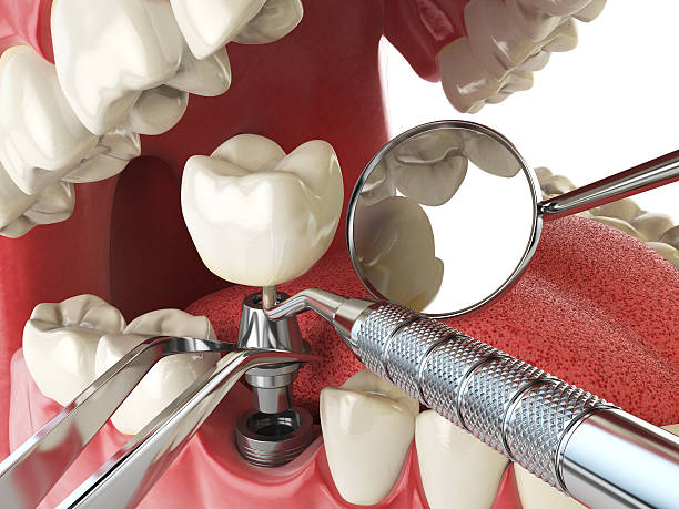 Best Emergency Denture Repair in Oakland, OK